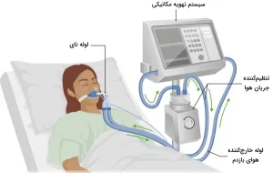 تعمیر دستگاه تنفس مصنوعی ونتیلاتور acutronic 6 تعمیر دستگاه تنفس مصنوعی ونتیلاتور acutronic - شرکت اویژه مد -تهران - کرج
